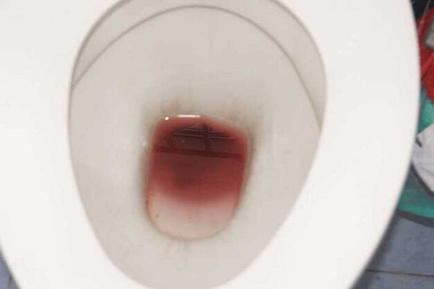 smērēšanās vīriešiem, kad tie ir satraukti